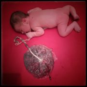 Geburtsbericht: Baby mit Plazenta