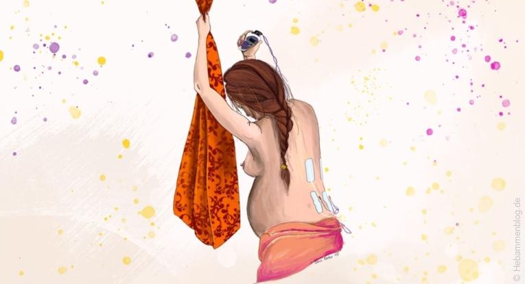 Schwangere mit Geburts-TENS unter Wehen